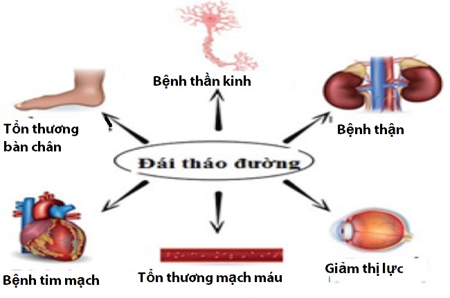 TÌM HIỂU VỀ CÁC TRƯỜNG HỢP BỆNH TIỂU ĐƯỜNG